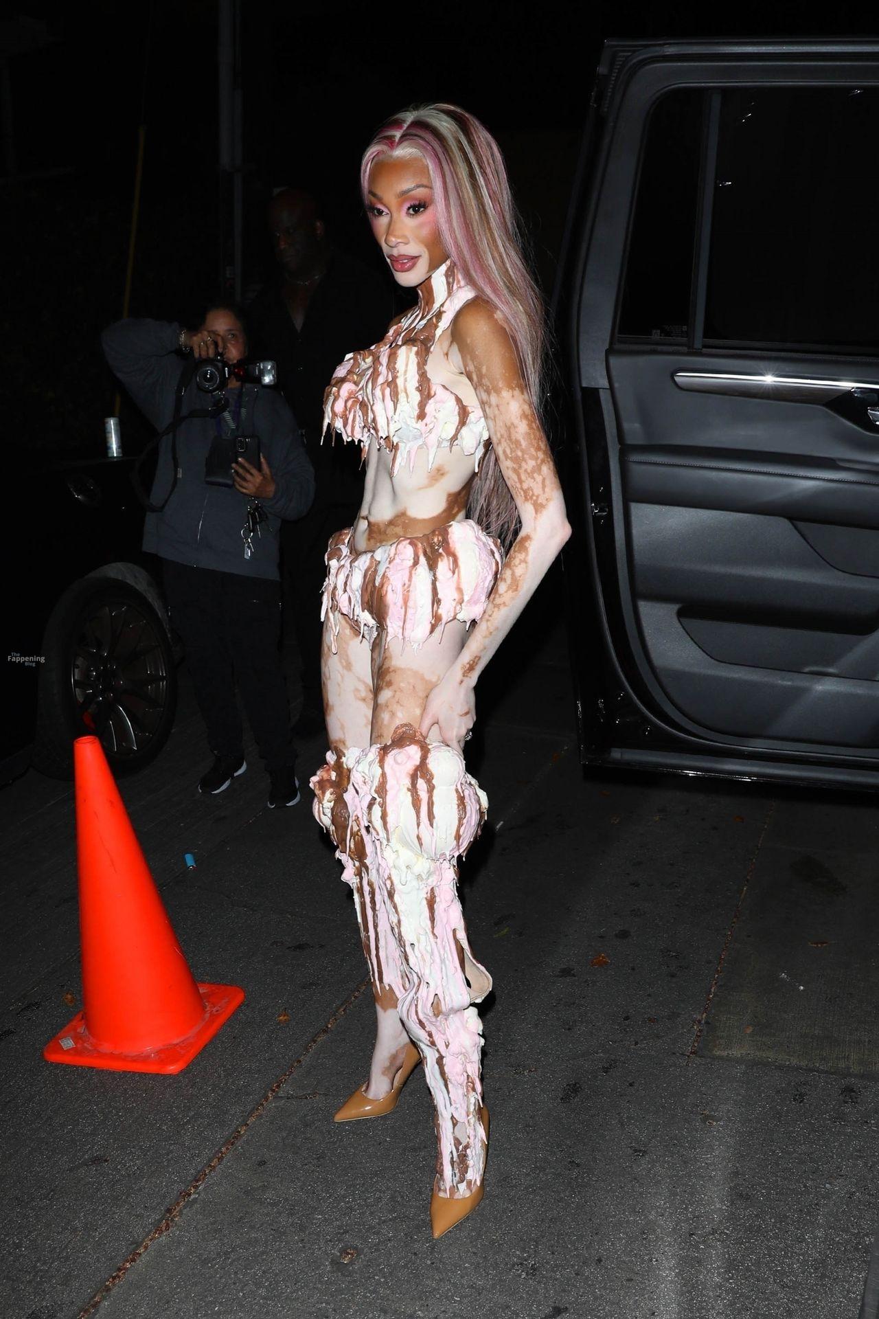 winnie-harlow-hot-31-the-fappening-pics